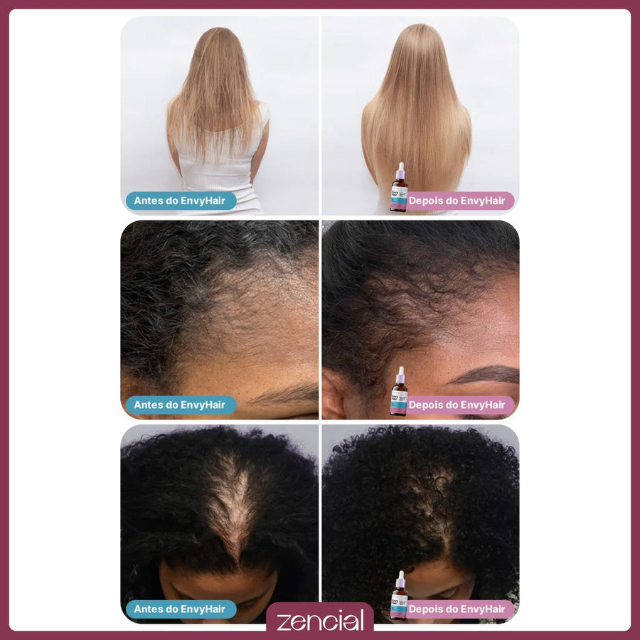 Sérum Capilar Blend de Óleos EnvyHair